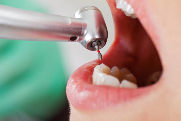 Best Emergency Denture Repair in Camp Hill, PA